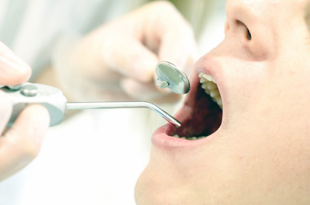 歯 の 治療 スピリチュアル