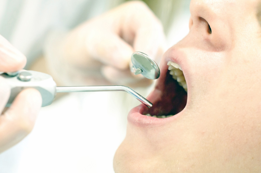 歯科と口腔外科の違い：抜歯ー迷いやすい診療科④