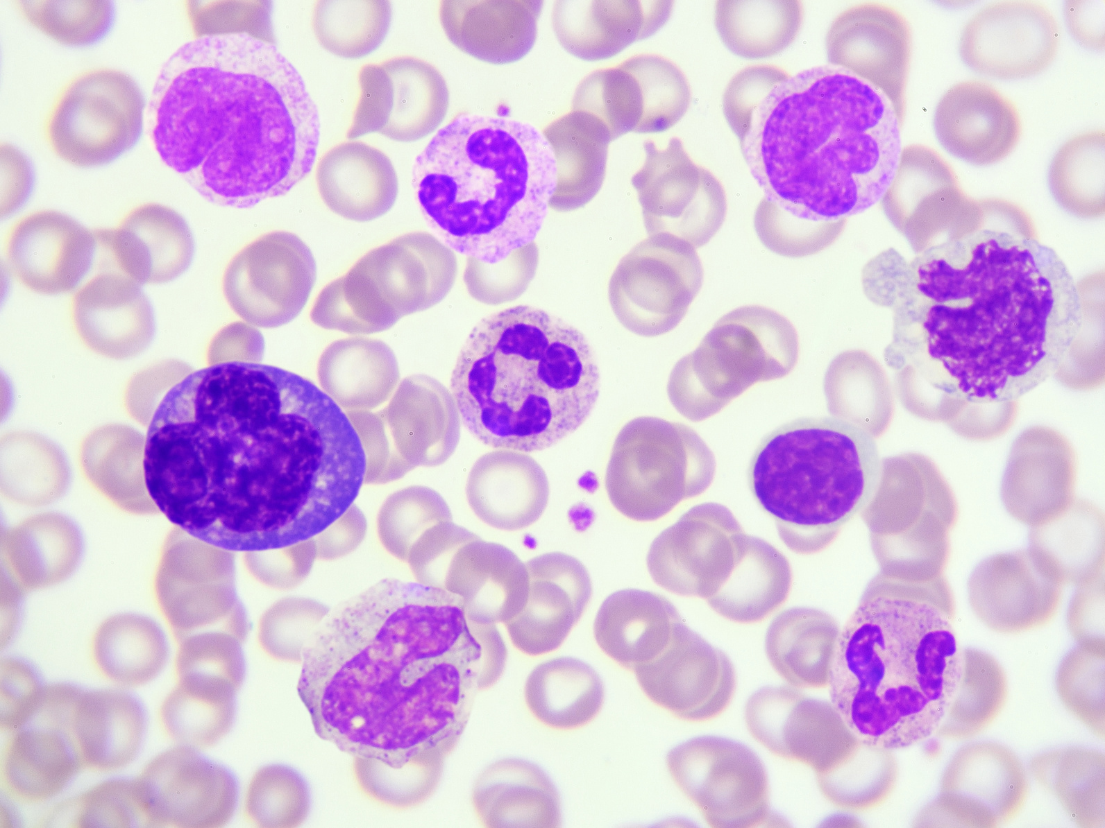 超え 白血球 多い 10000 血液検査で白血球を調べると何が分かるの？
