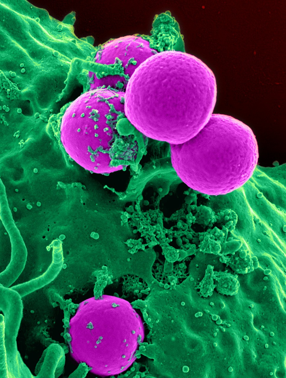 多い 10000 超え 白血球 白血球が多い原因は？花粉症やアトピー性皮膚炎の反応も！再検査について